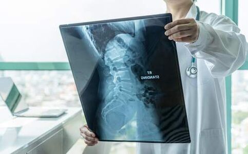 An X-ray is a necessary diagnostic method if your back hurts